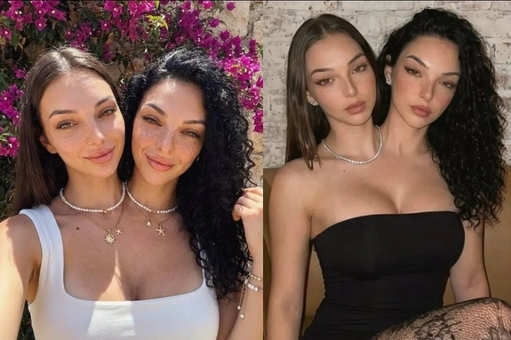 비키니 입은 ‘샴쌍둥이’에 33만이 몰린 이유