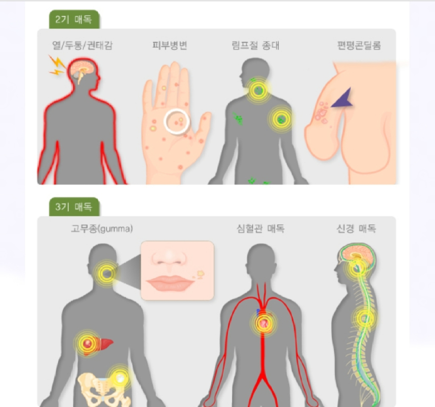 사진=국가건강포털 1000015502.jpg
